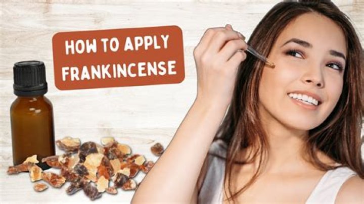 Does frankincense need a carrier oil?