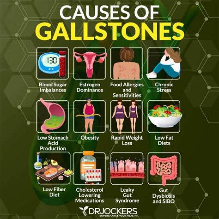How do you get rid of gallstones at home?