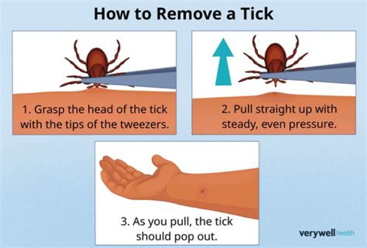 How do you remove a tick without tweezers?