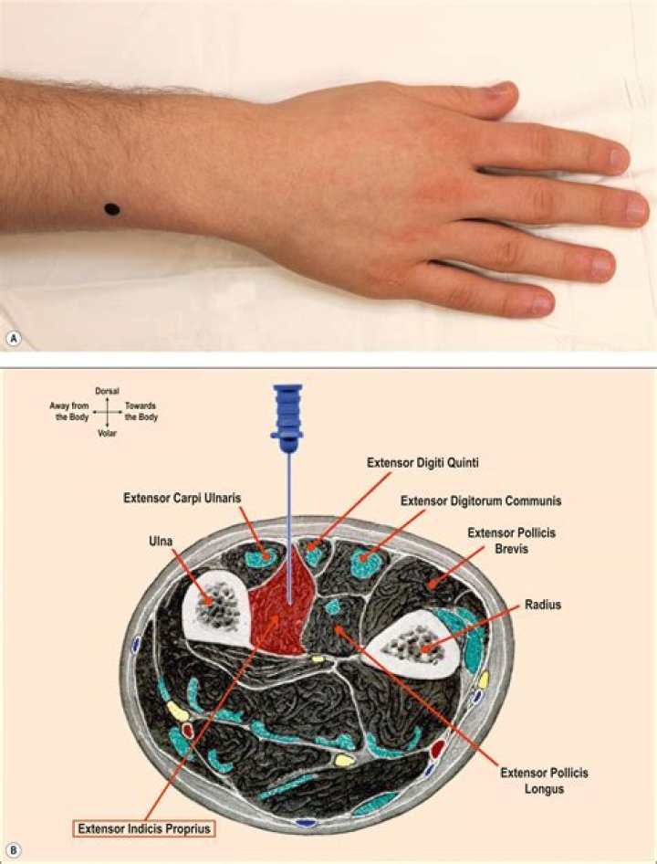 How do you test for extensor Indicis?