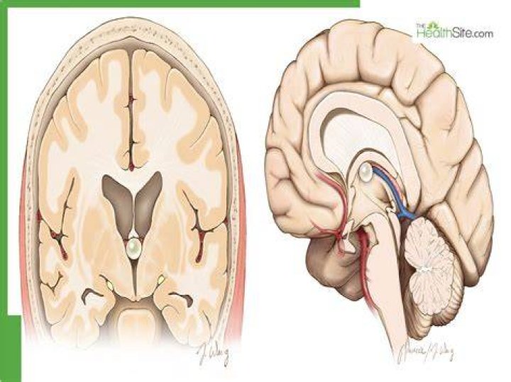Is cyst in brain dangerous?