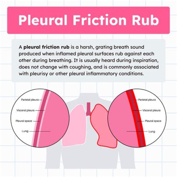 What causes friction rub in lungs?