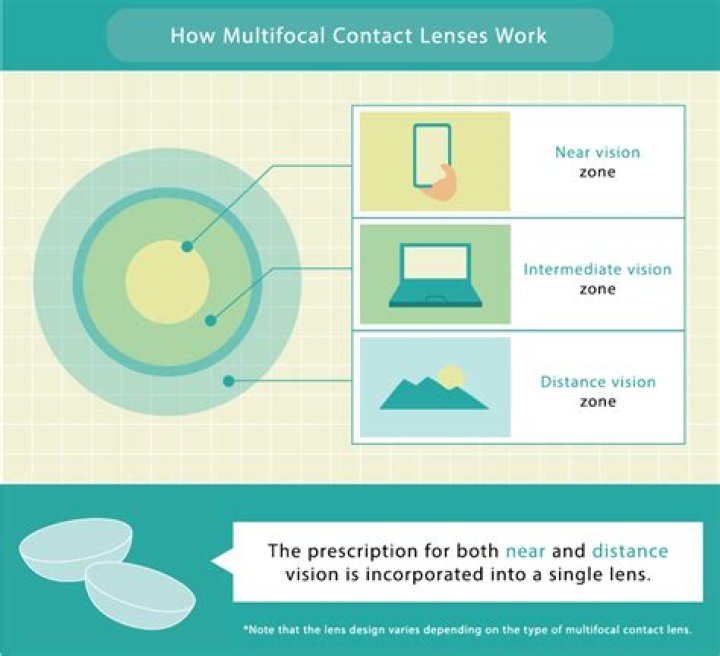 What is multifocal ERG test?