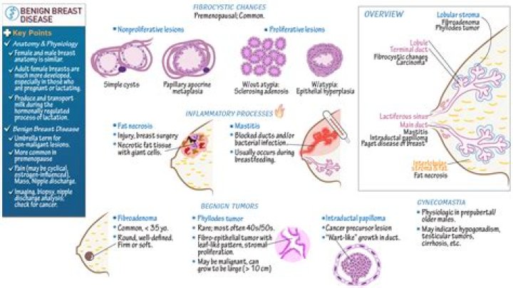 What is non proliferative breast disease?
