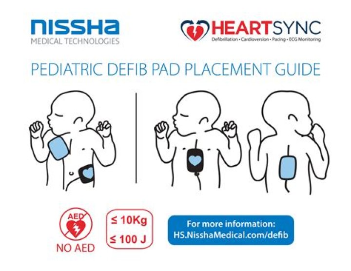 Where is the proper location to attach AED pads on a child?